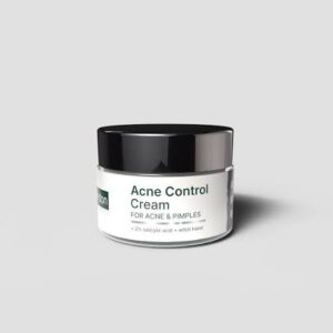 Acne Control Treatment Cream